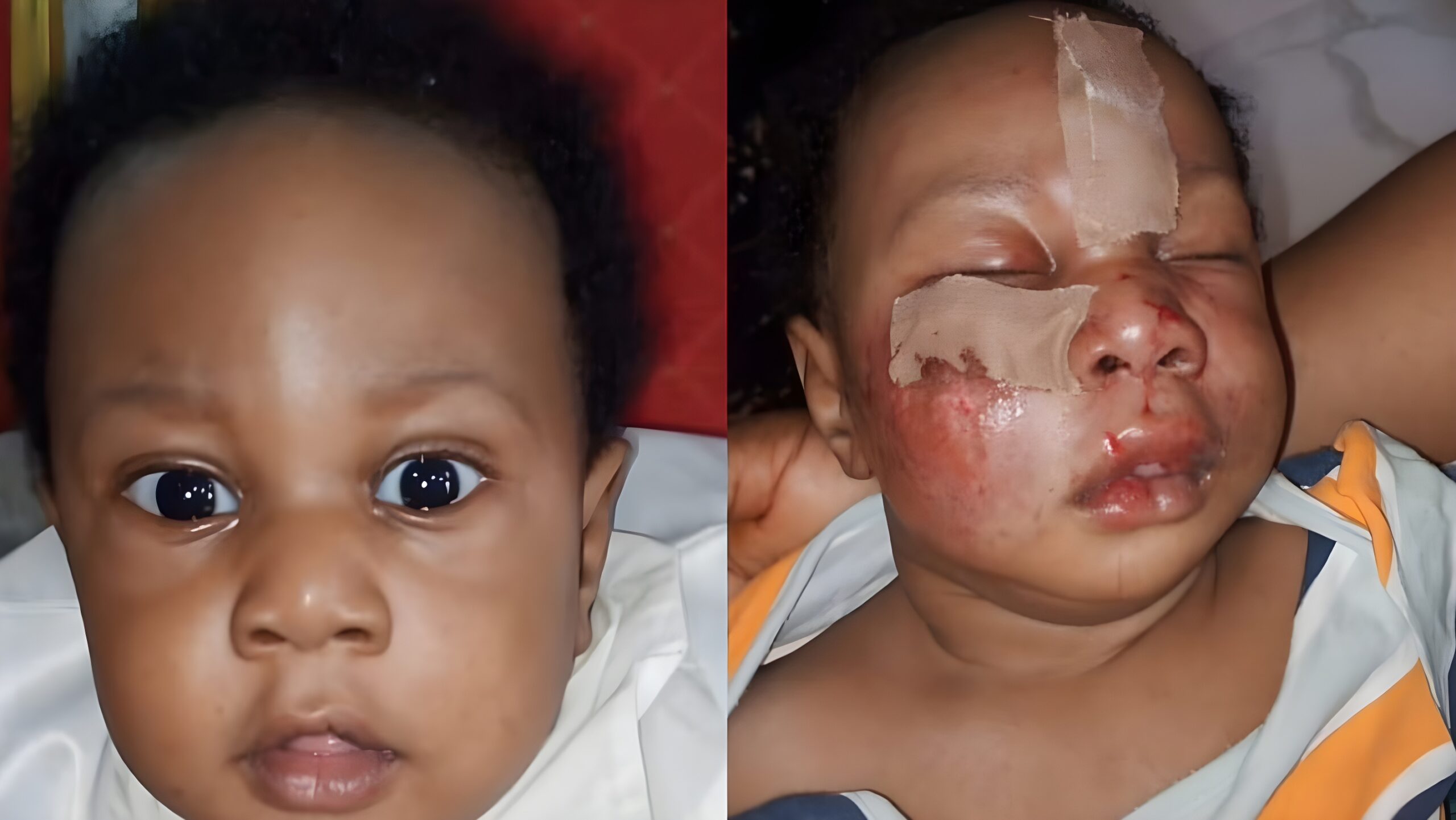 Baby battles for life after alleged animal bite in Lagos daycare